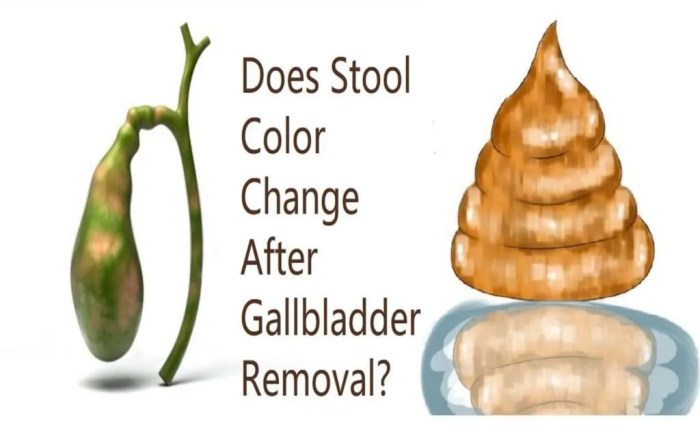 What color should gallbladder mucosa be