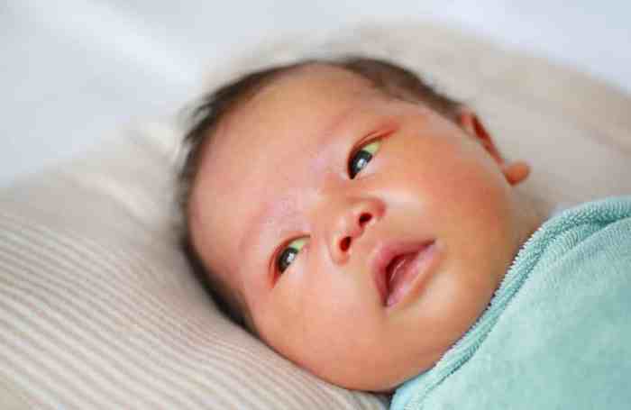 Hesi newborn with jaundice case study